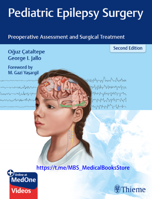 MCU_2020_Pediatric_Epilepsy_Surgery_Preoperative_Assessment_and.pdf